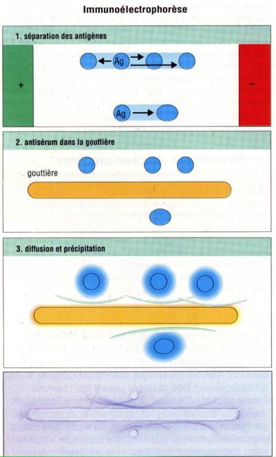 Vers quoi rêve les parasites dans le corps de la personne